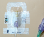 An example picture of a cannula