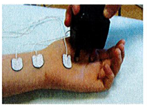 Image depicting electrodes on child's hand