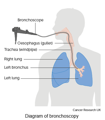 Diagram of a bronchoscope