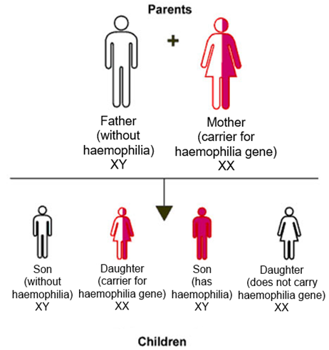A infographic showing how haemophilia is passed on from parents to children