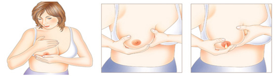 An example image of a breast expressing milk