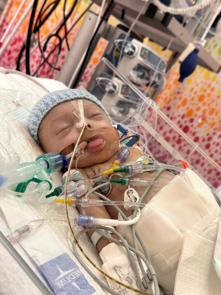 Photo of new born baby in an ICU cot