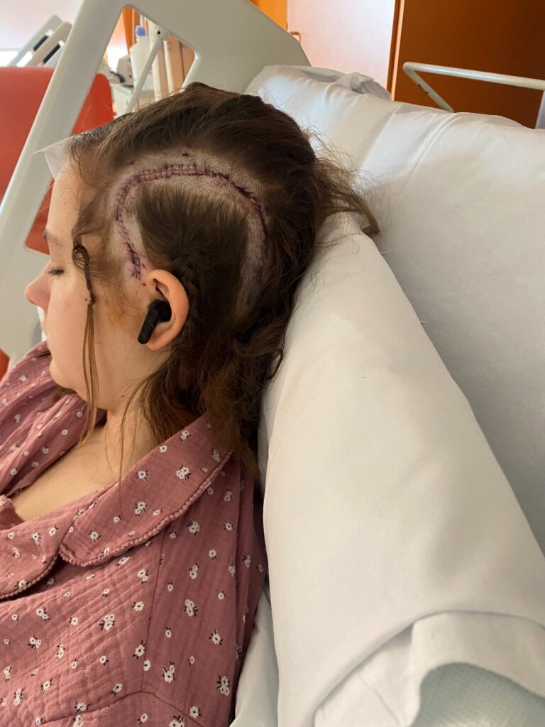 Photo of Tilly and her scar