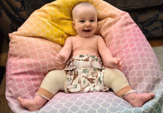 baby in hip brace