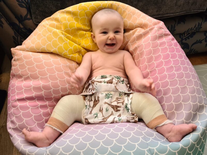 baby in hip brace